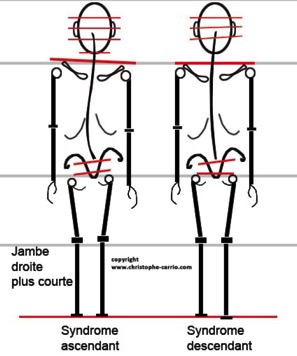 carrio-jambe-courte