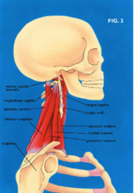 Stop aux douleurs de nuque et fourmillements dans les mains - CTS ...