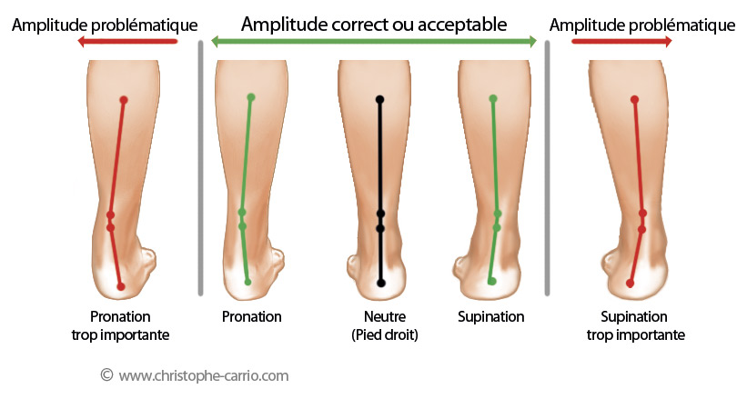 Douleur tibia - periostite du tibia : en finir avec le mal de tibia